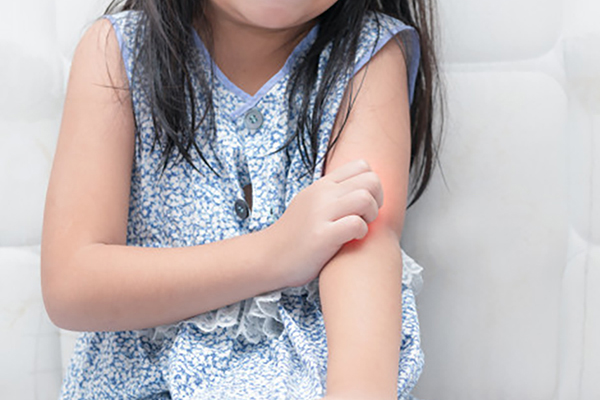 4 Fakta Alergi pada Anak-Anak